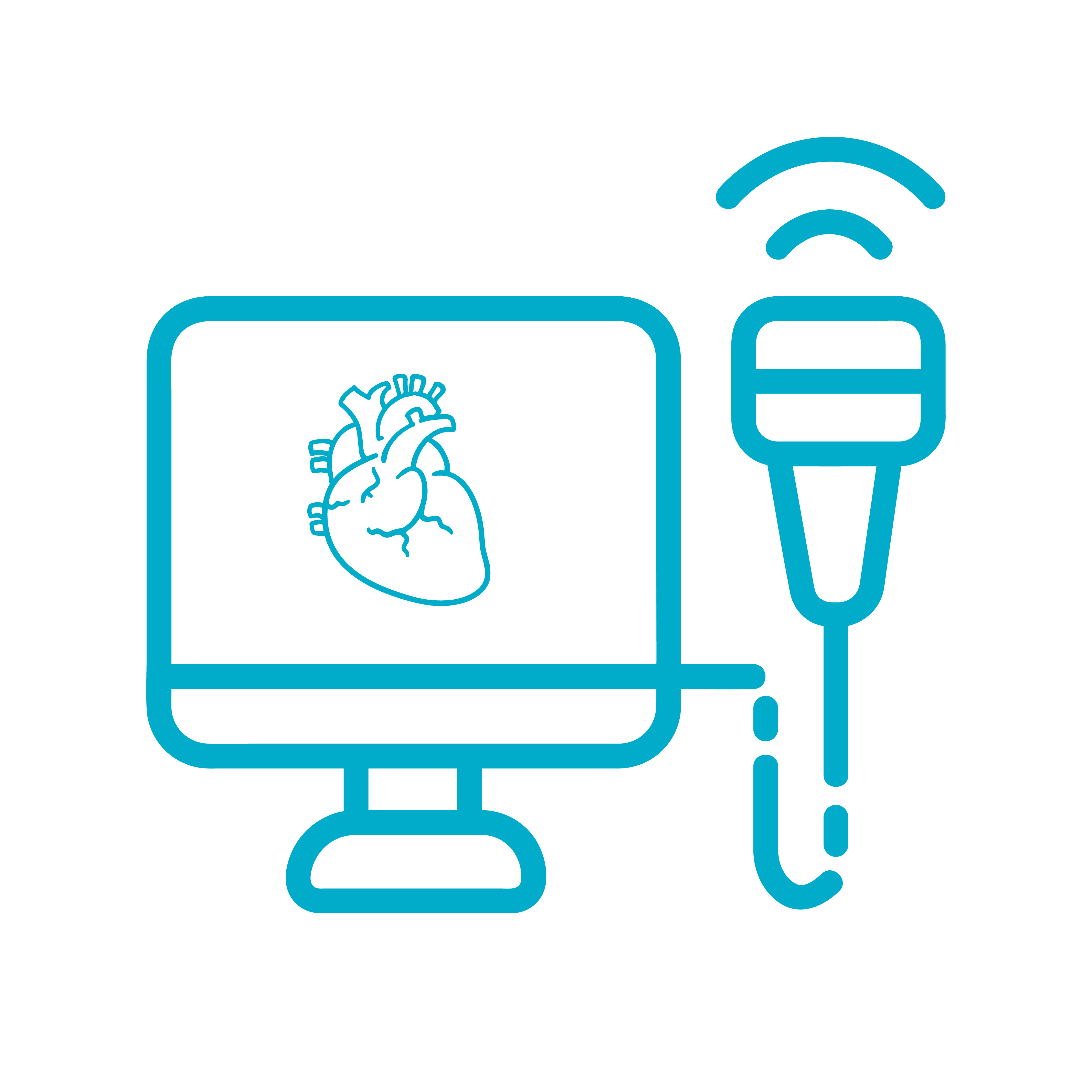 Ecocardiograma